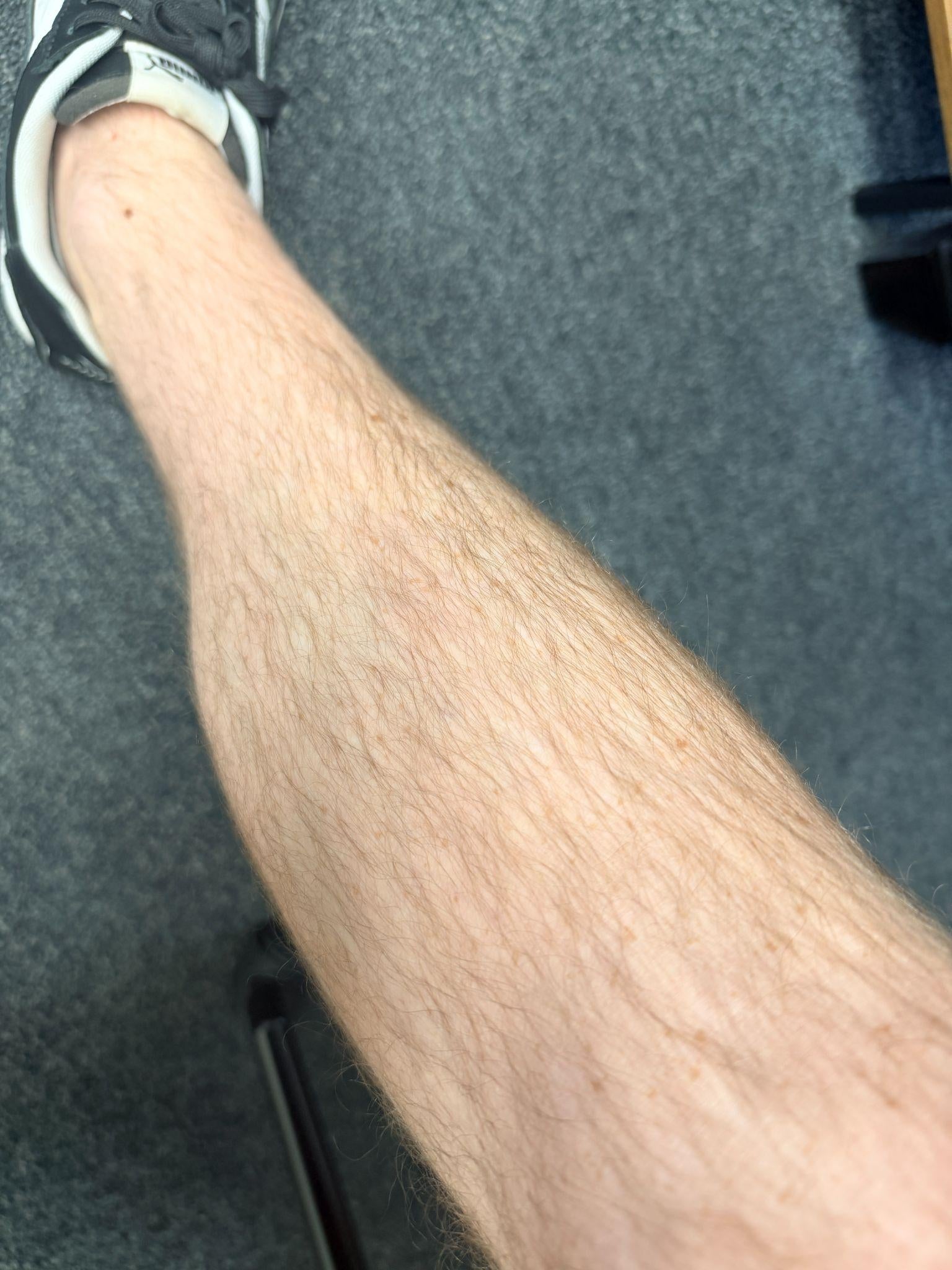 After using Lume Tallow
