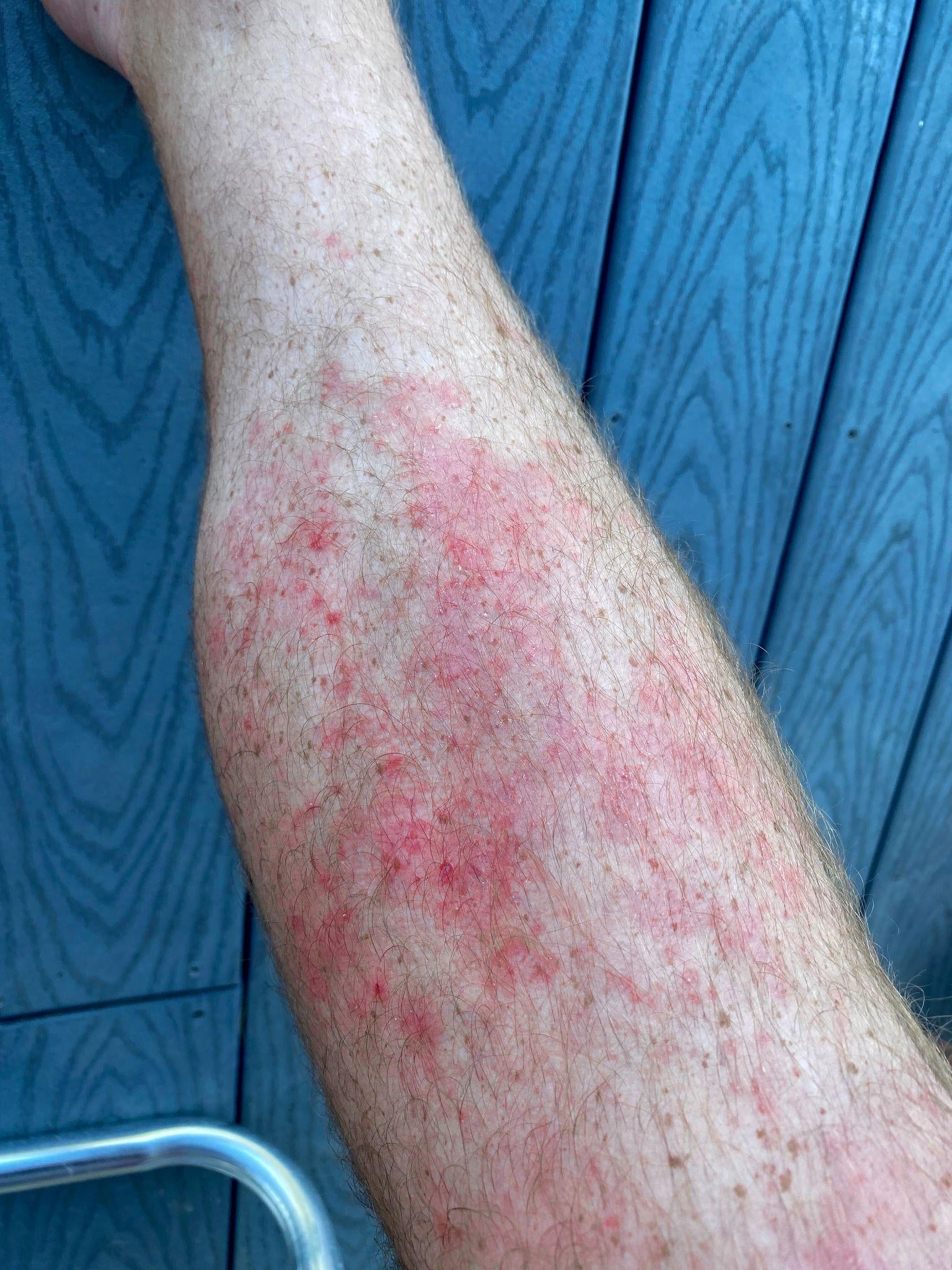 Before using Lume Tallow